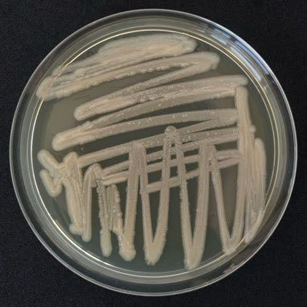 Xanthomonas euvesicatoria